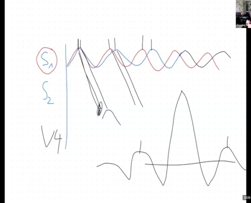 05_shared-whiteboard-live-explanation_01-03-00